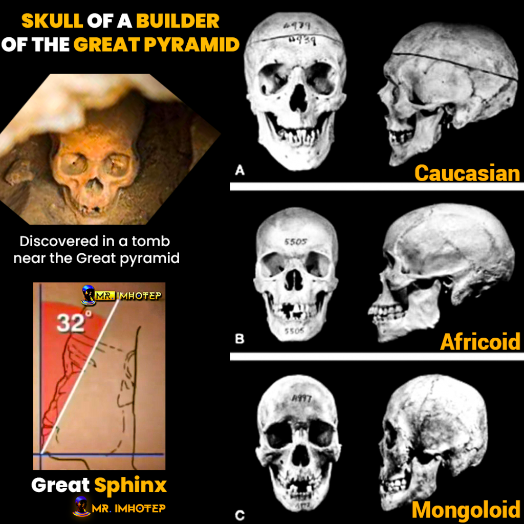Skull of a builder of the great pyramid