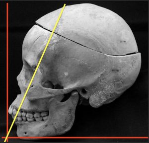 Skull prognathism angles