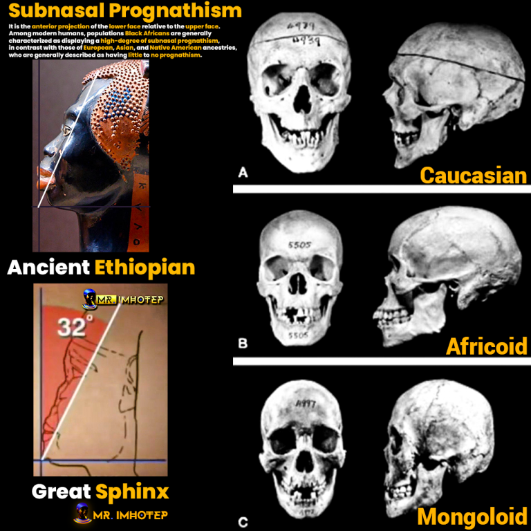 Subnasal Prognathism Ancient Ethiopian Great Sphinx Skull comparison